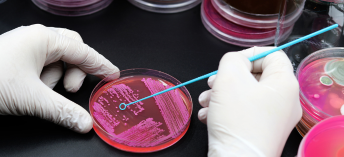 Hematology department